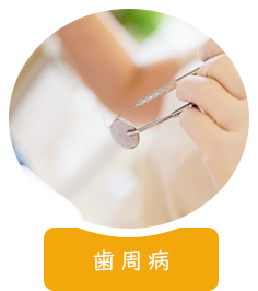 歯周病 歯ぐきがイタイ